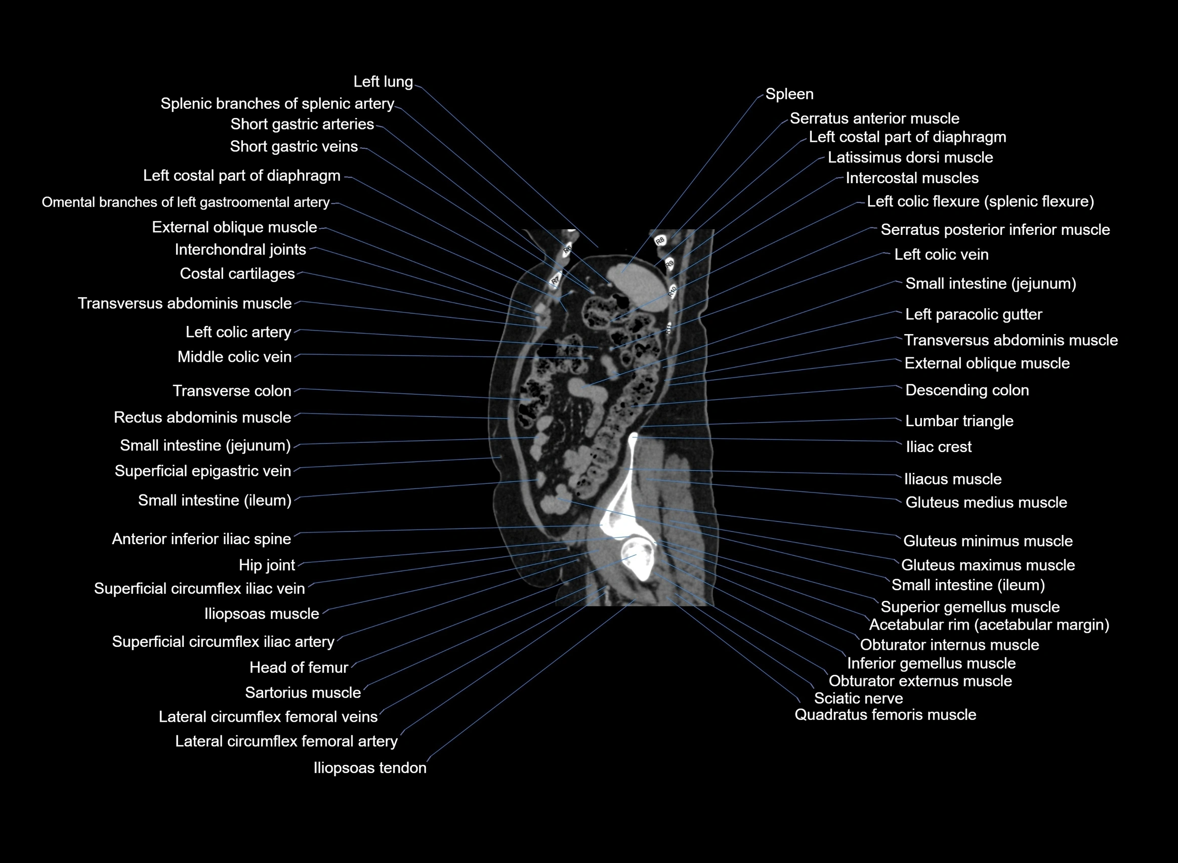 CT Abdomen sagittal cross sectional anatomy labelled radiology image -00025.webp